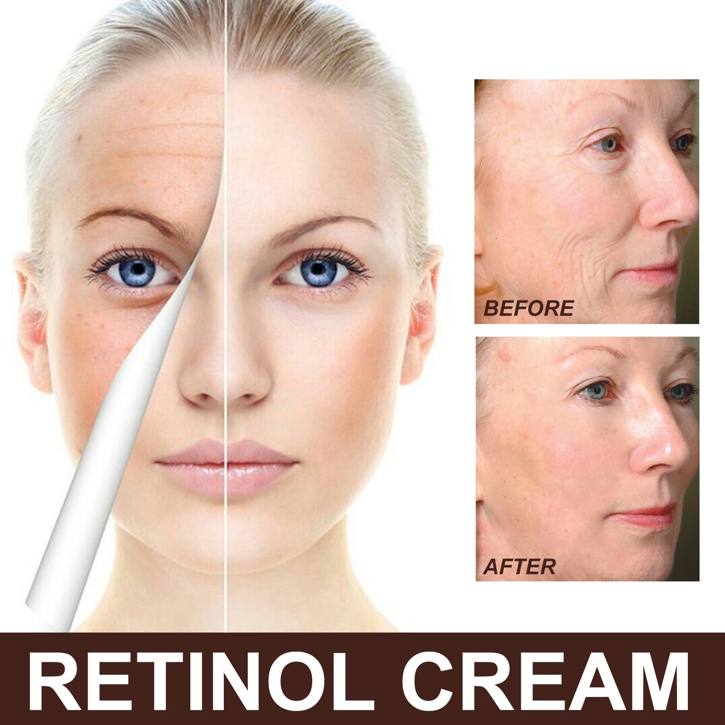 Retinol Anti Aging Wrinkle Removal Skin Firming Cream, EELHOE Retinol Cream Anti-Aging With Hyaluronic Acid And Vitamin