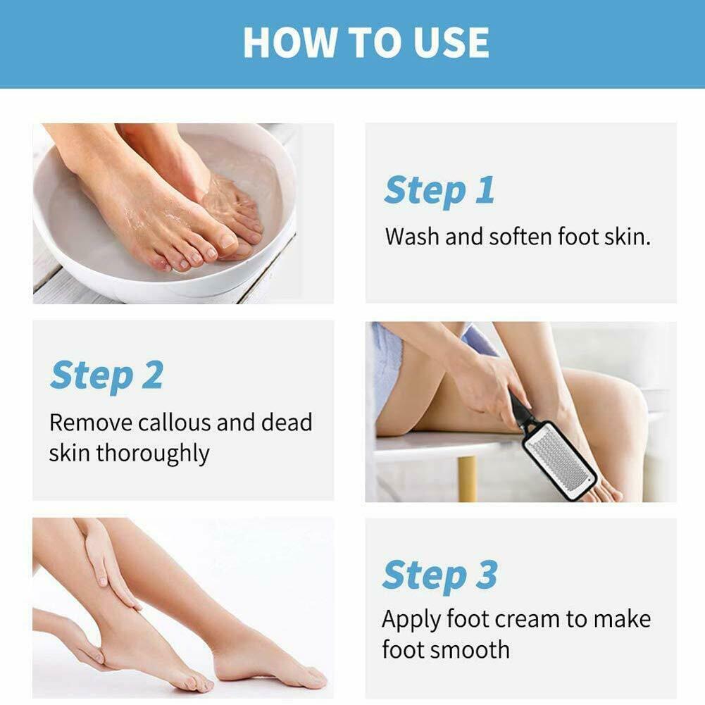 Professional Foot Callus Remover File