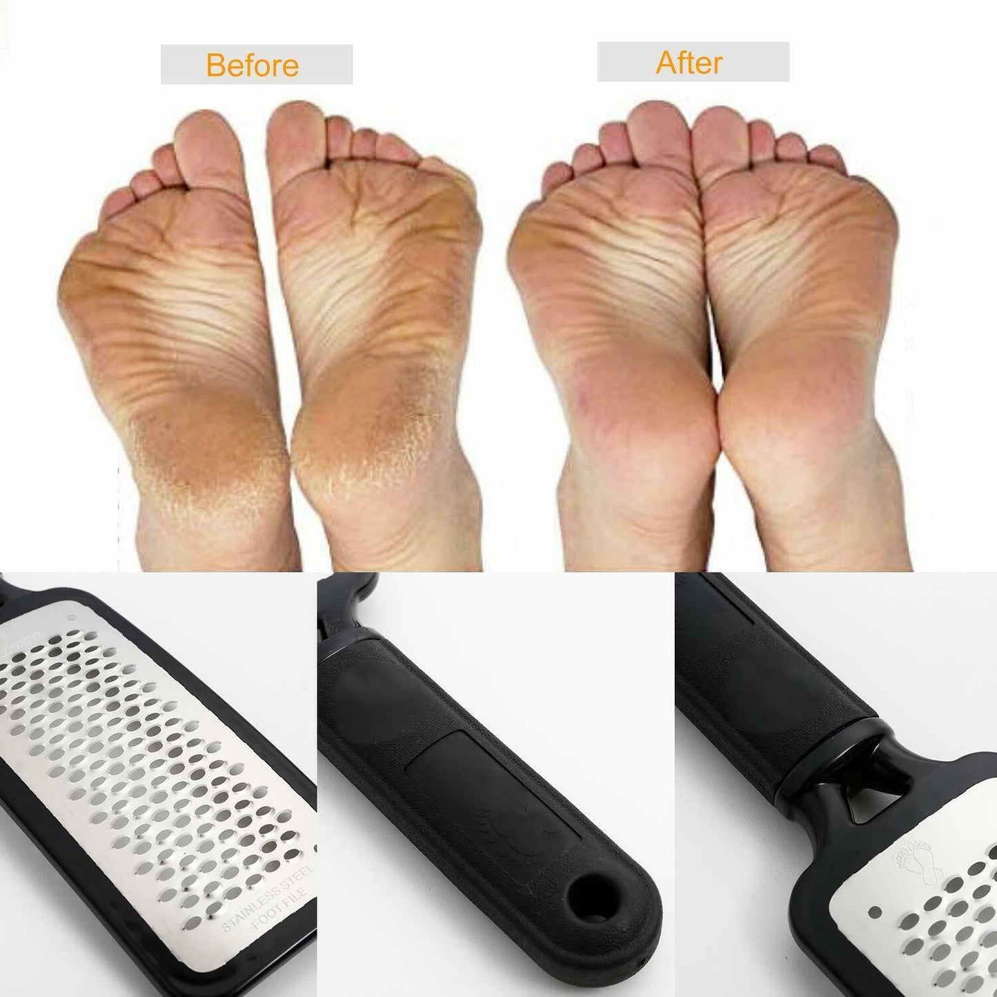 Professional Foot Callus Remover File