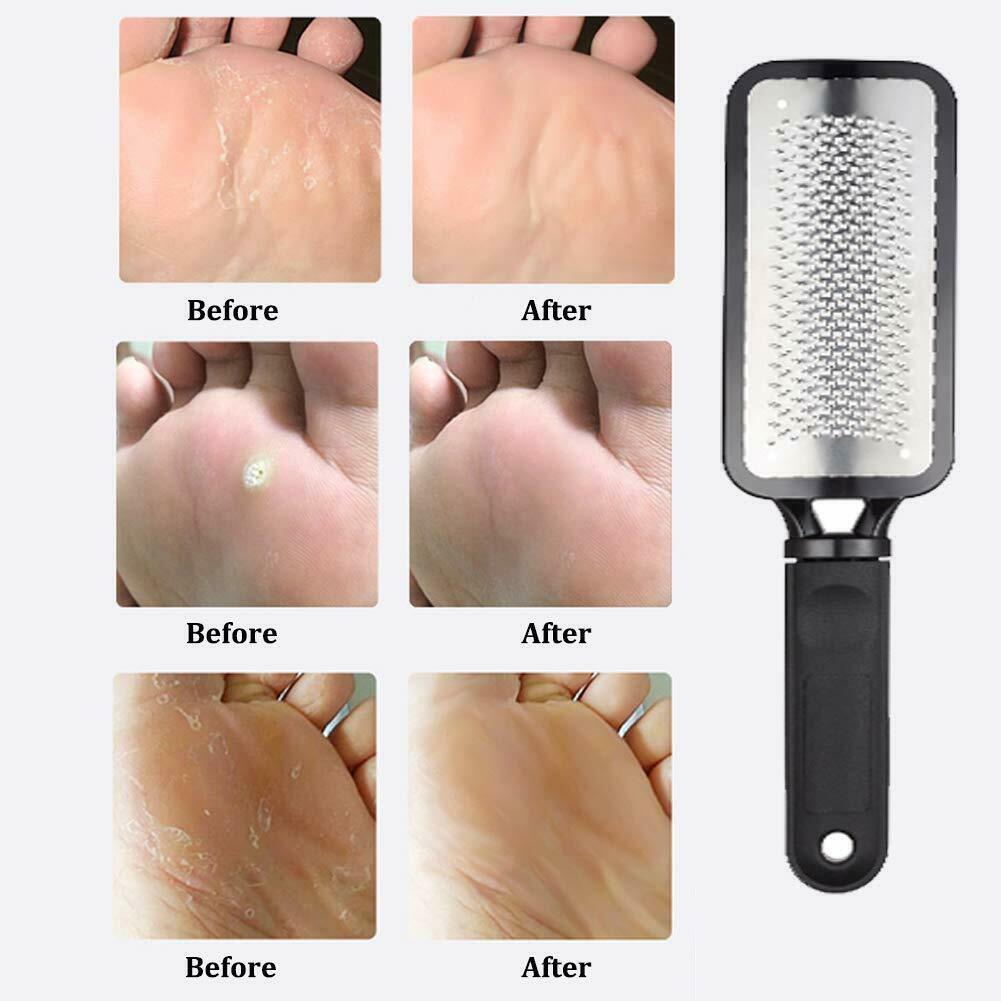 Professional Foot Callus Remover File